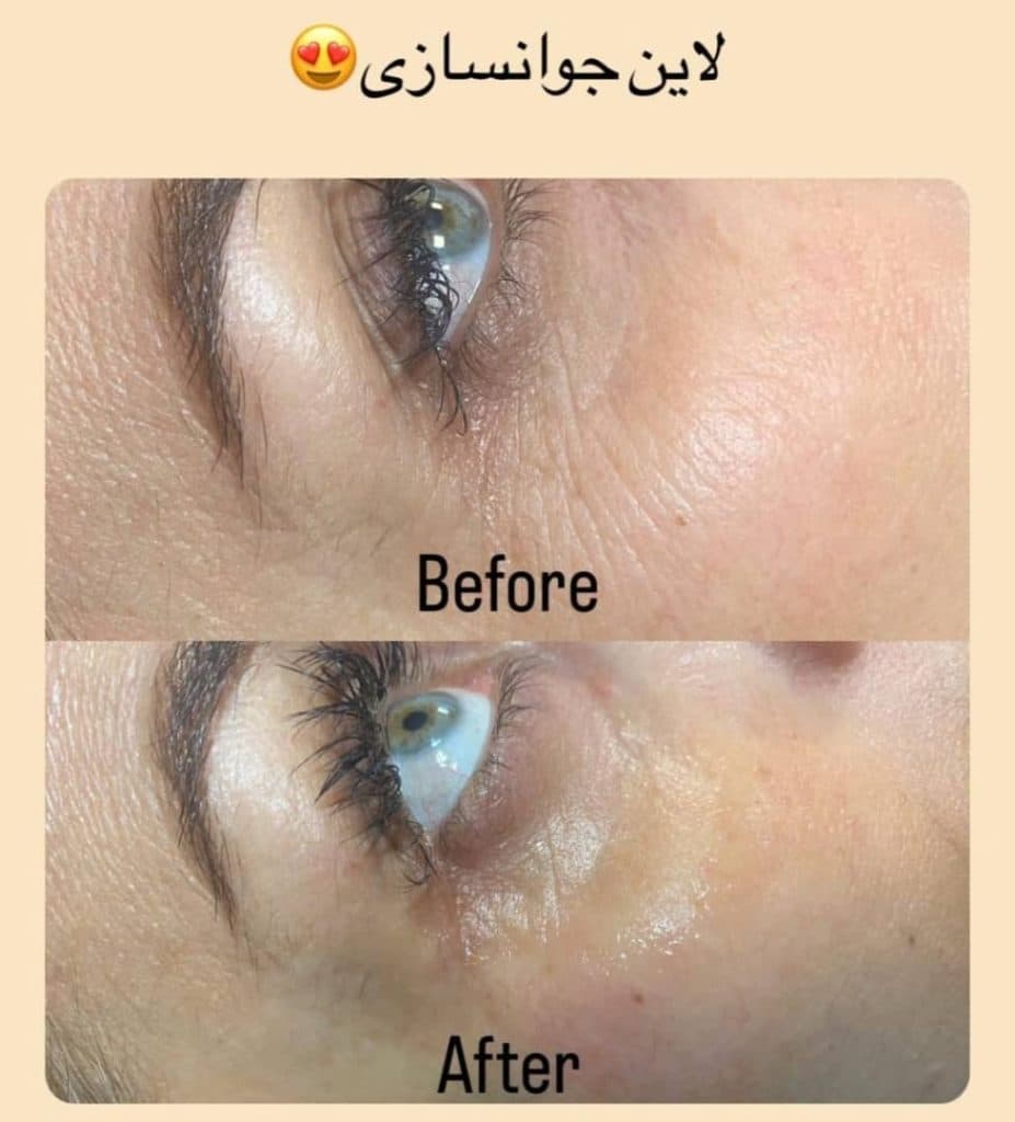 آکادمی آموزش خدمات پاکسازی و مراقبت از پوست و مو نگار سعیدزنوزی در هشتگرد