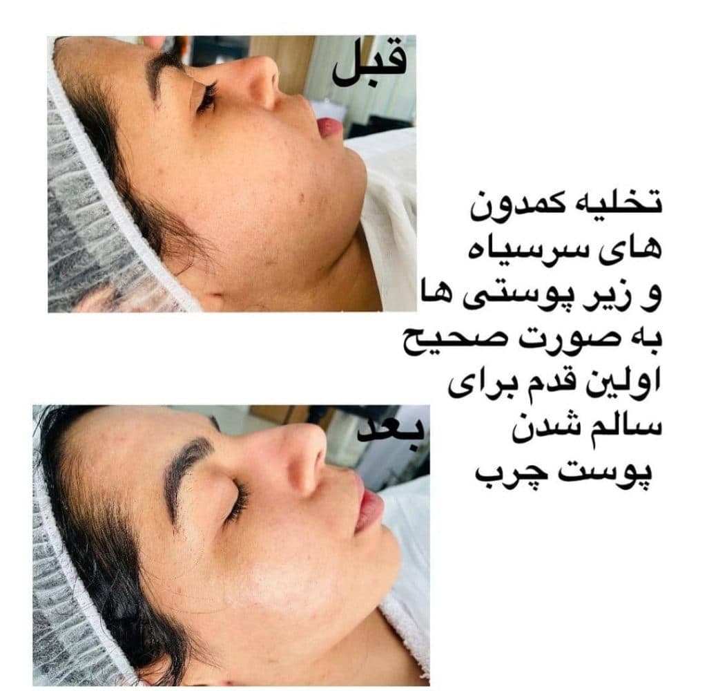 آکادمی تخصصی آموزش و خدمات پاکسازی مراقبت از پوست و مو رویا دهقانی در بندرعباس