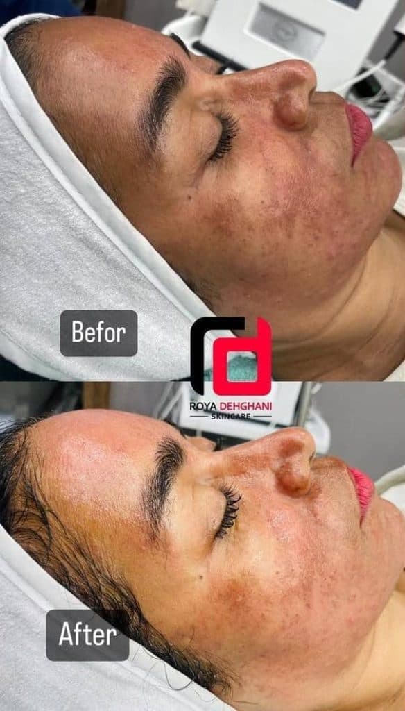 آکادمی تخصصی آموزش و خدمات پاکسازی مراقبت از پوست و مو رویا دهقانی در بندرعباس