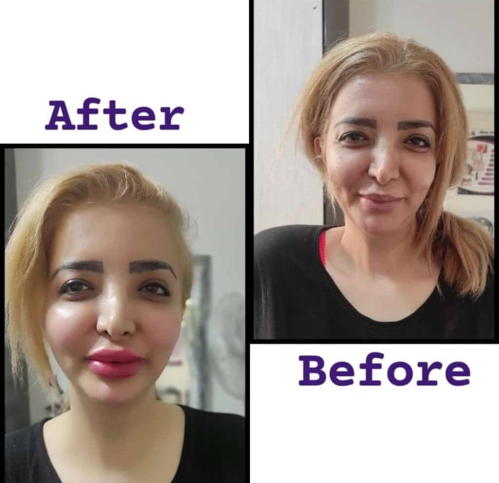 کلینیک زیبایی لیزر مارال در کرج