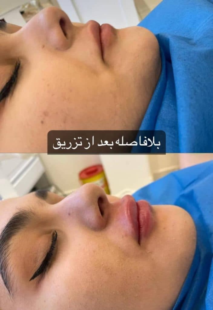 مرکز تخصصی تزریق ژل و بوتاکس وایتال فورس در 17 شهریور جدید تبریز