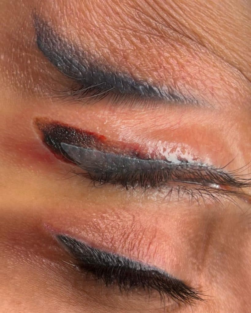 ریمو و تتوی صورت سحر ثانی رشت