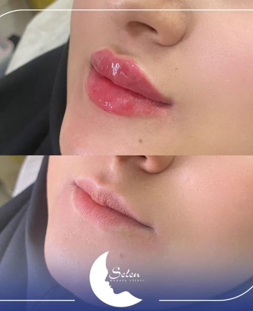 کلینیک زیبایی پوست و مو سلن در بلوار سجاد مشهد