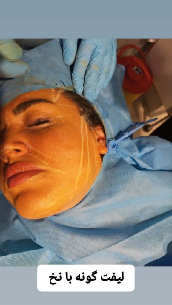 مرکز زیبایی بوتاکس و ژل درنیکا در بوشهر