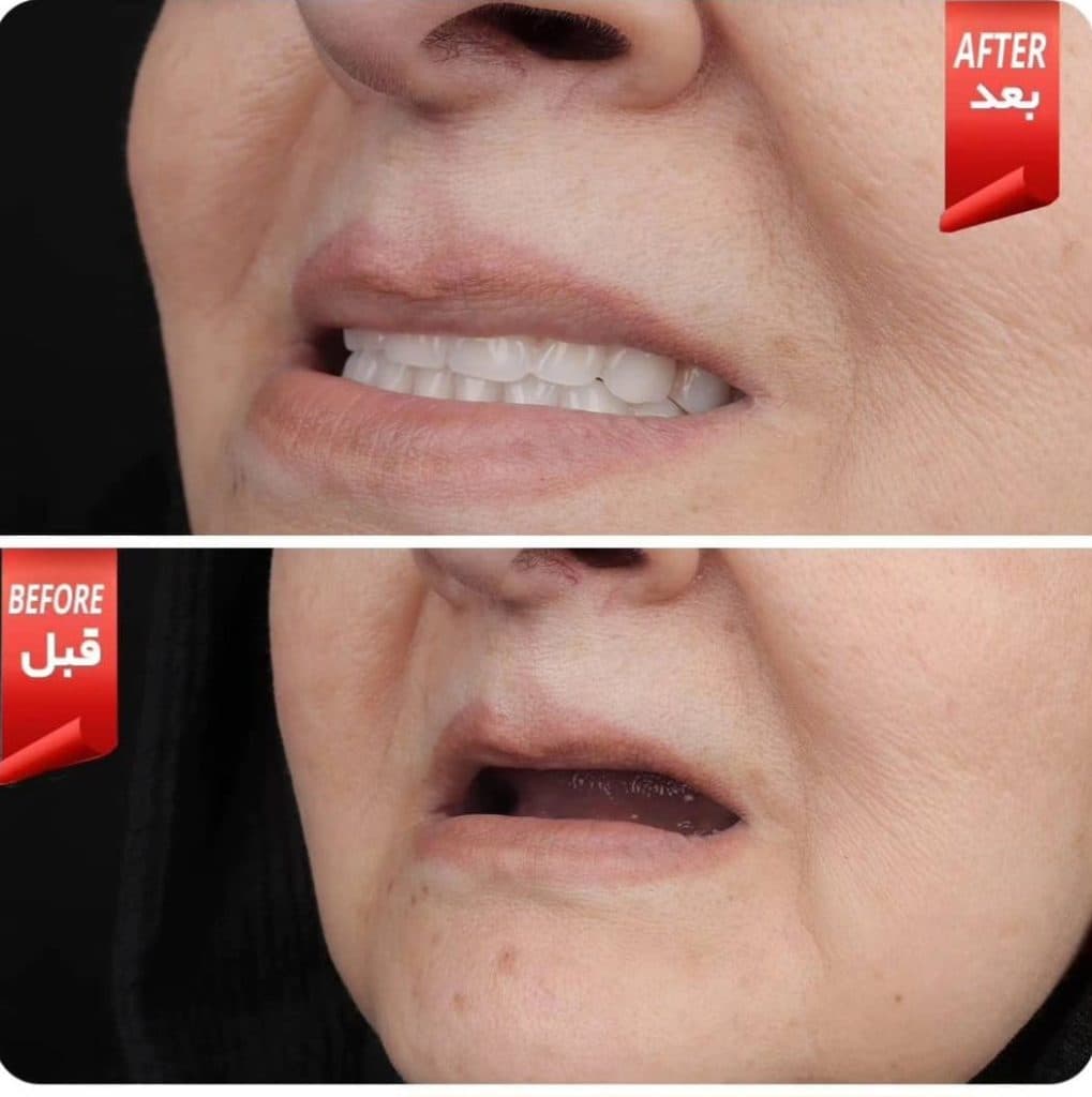 دندانسازی زارعی در یزد