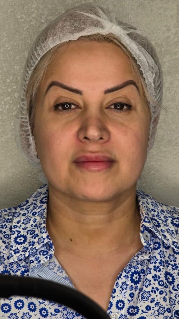 کلینیک زیبایی دکتر معین متین در میرداماد تهران