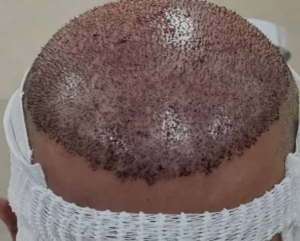 خدمات پرستاری و درمانی در منزل شهروند زیباجو در قشم