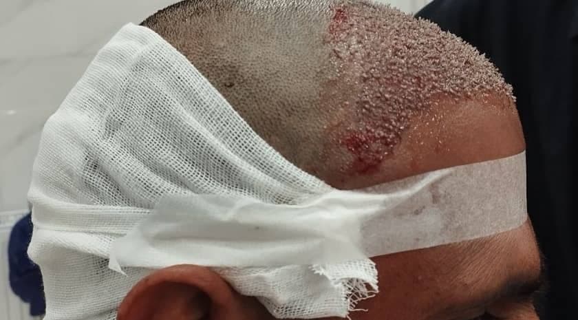 خدمات پرستاری و درمانی در منزل شهروند زیباجو در قشم