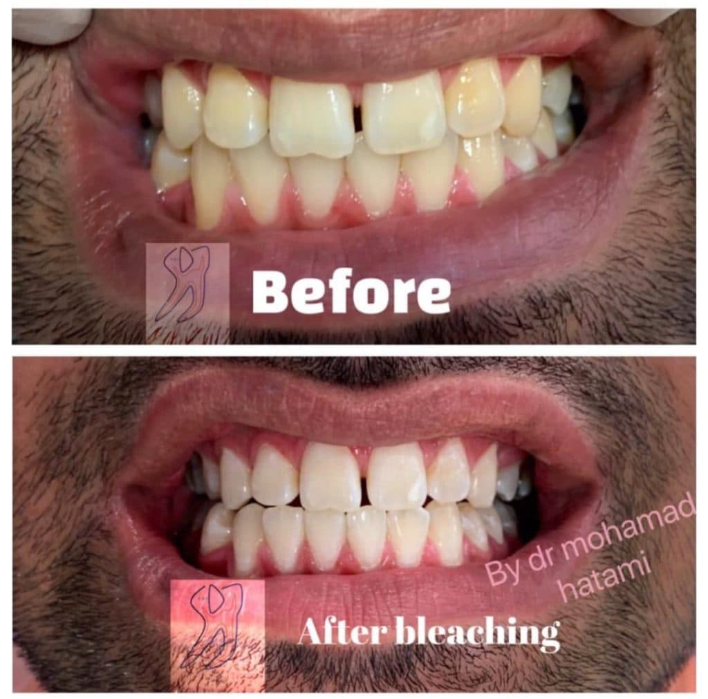 مطب دندانپزشکی دکتر محمد حاتمی در کرمان