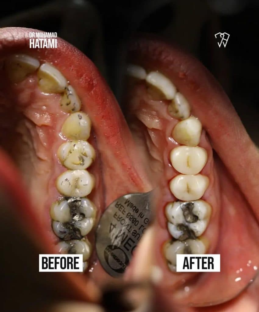 مطب دندانپزشکی دکتر محمد حاتمی در کرمان