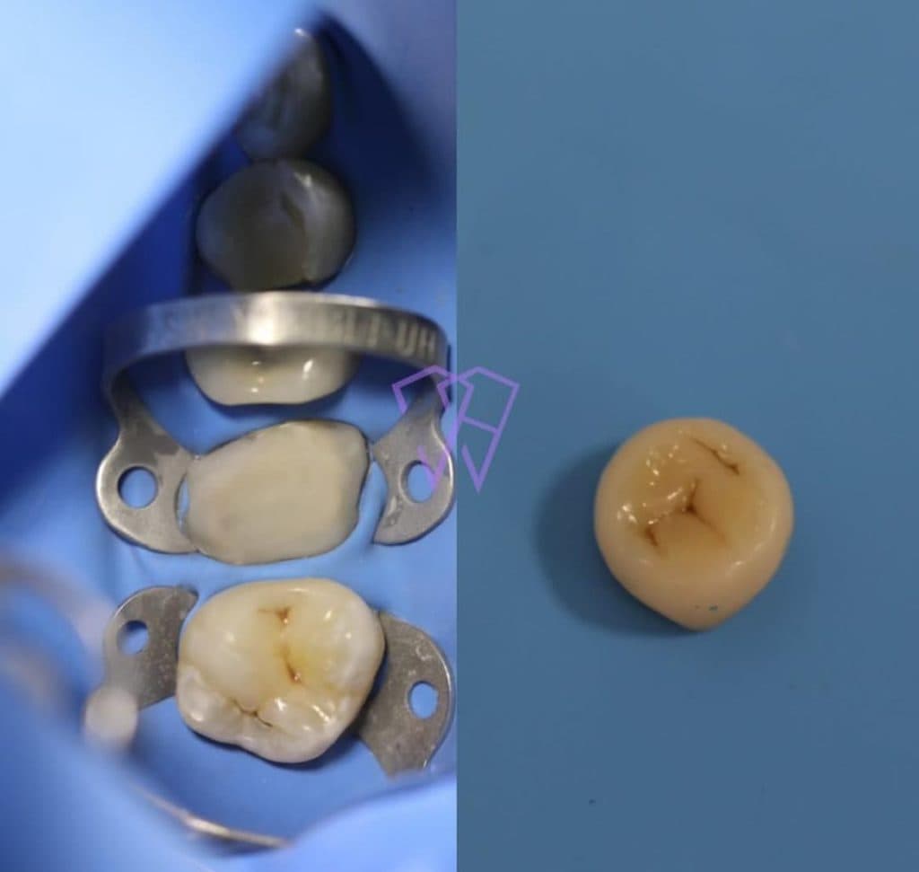 مطب دندانپزشکی دکتر محمد حاتمی در کرمان