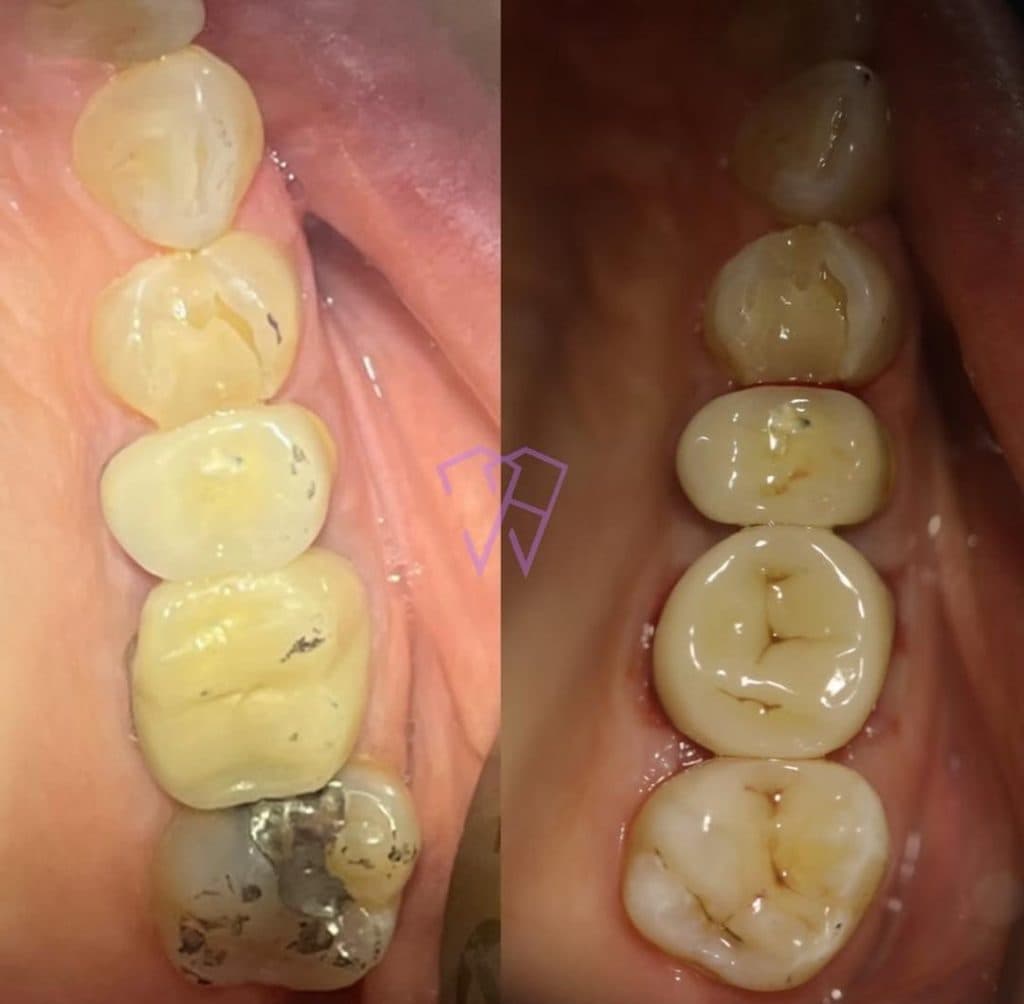 مطب دندانپزشکی دکتر محمد حاتمی در کرمان