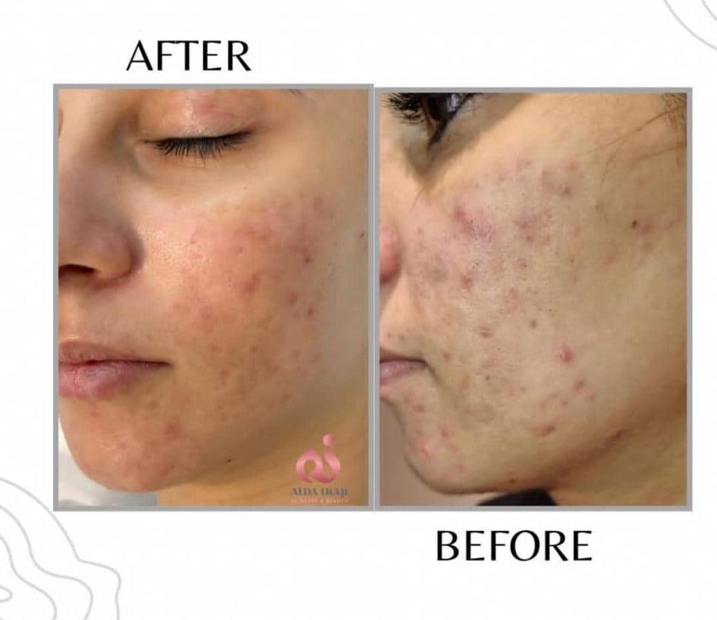 مرکز آموزش خدمات پاکسازی پوست و مو آیدا ایرجی در شیراز