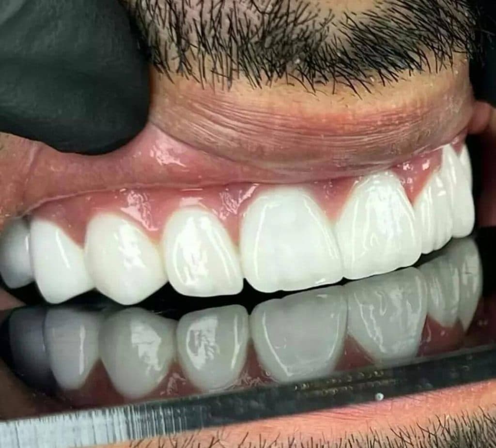 کلینیک دندانپزشکی باران در آبرسان تبریز