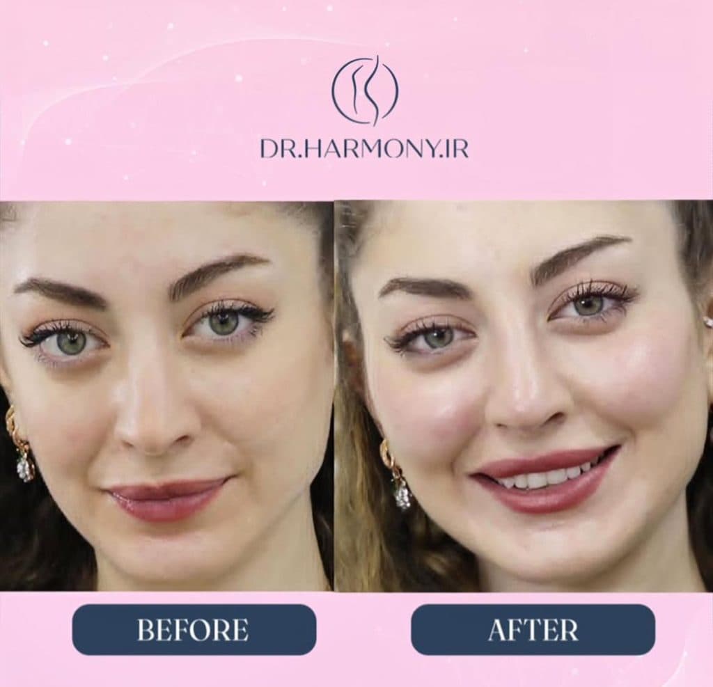 مطب زیبایی دکتر هارمونی در اندرزگو تهران