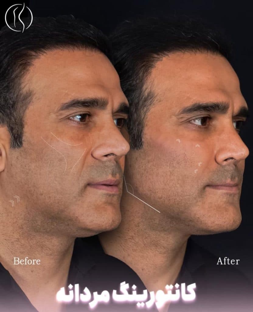 مطب زیبایی دکتر هارمونی در اندرزگو تهران