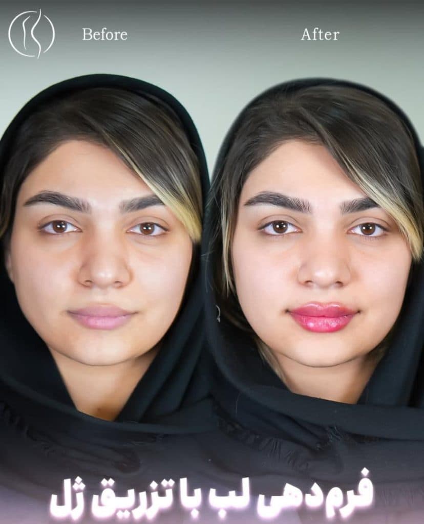 مطب زیبایی دکتر هارمونی در اندرزگو تهران