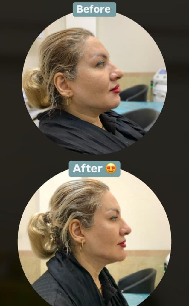 کلینیک زیبایی ماهلین شات در بندرعباس