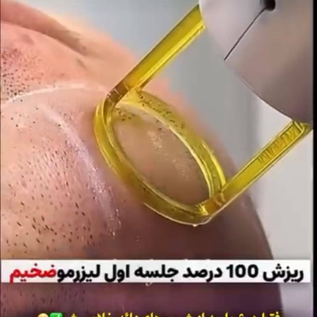 کلینیک تخصصی مزونیدلینگ صدف در کرج