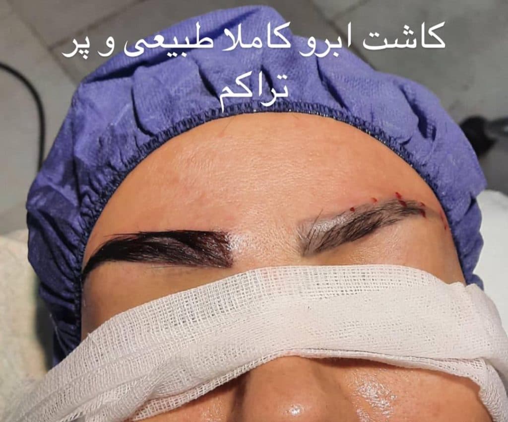 کلینیک زیبایی و درمانی اروین در احمدآباد مشهد