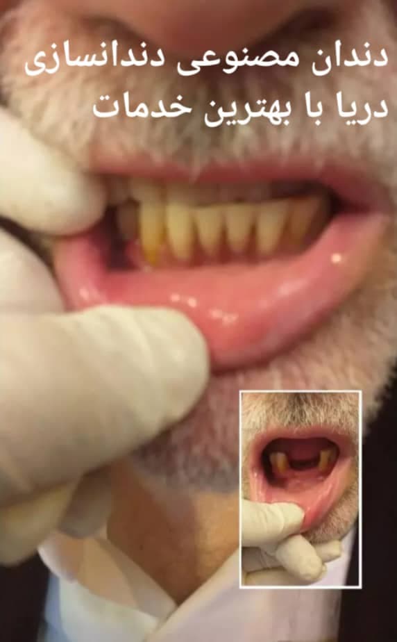 لابراتوار دندانسازی اقساطی دریا در تجریش تهران