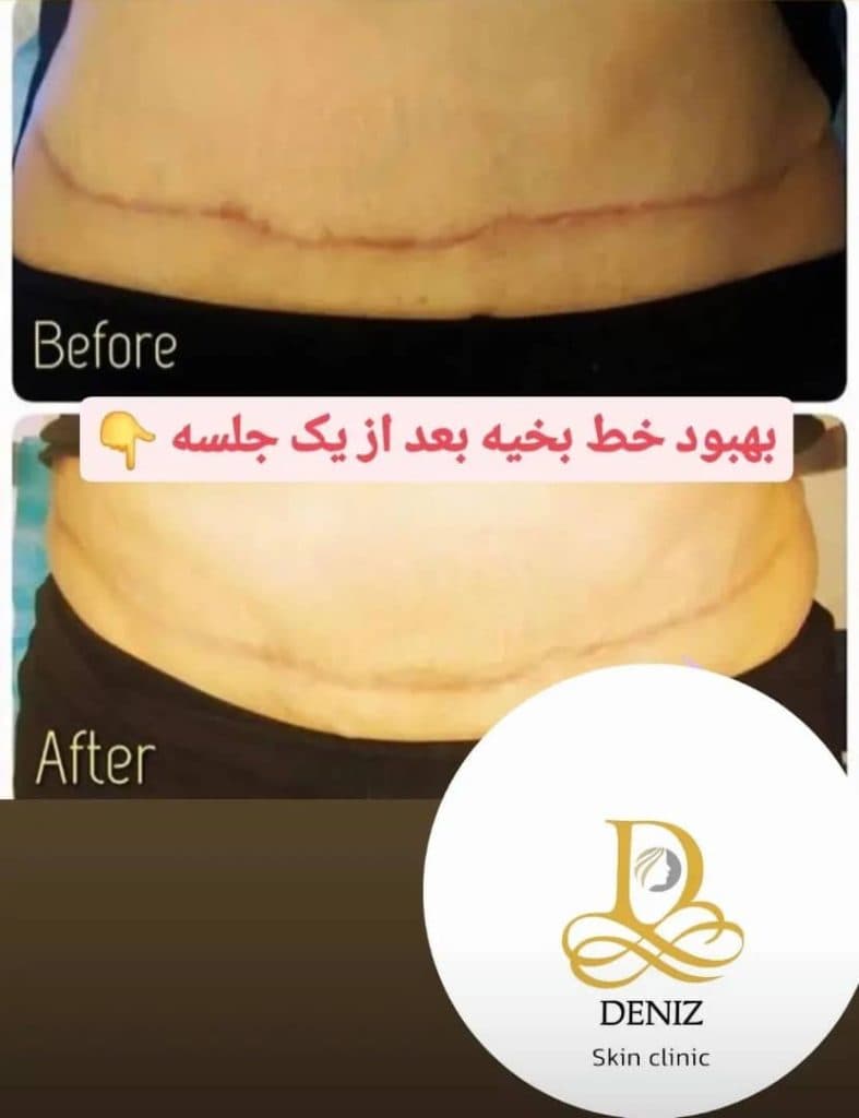 کلینیک زیبایی دنیز در پاستور جدید تبریز