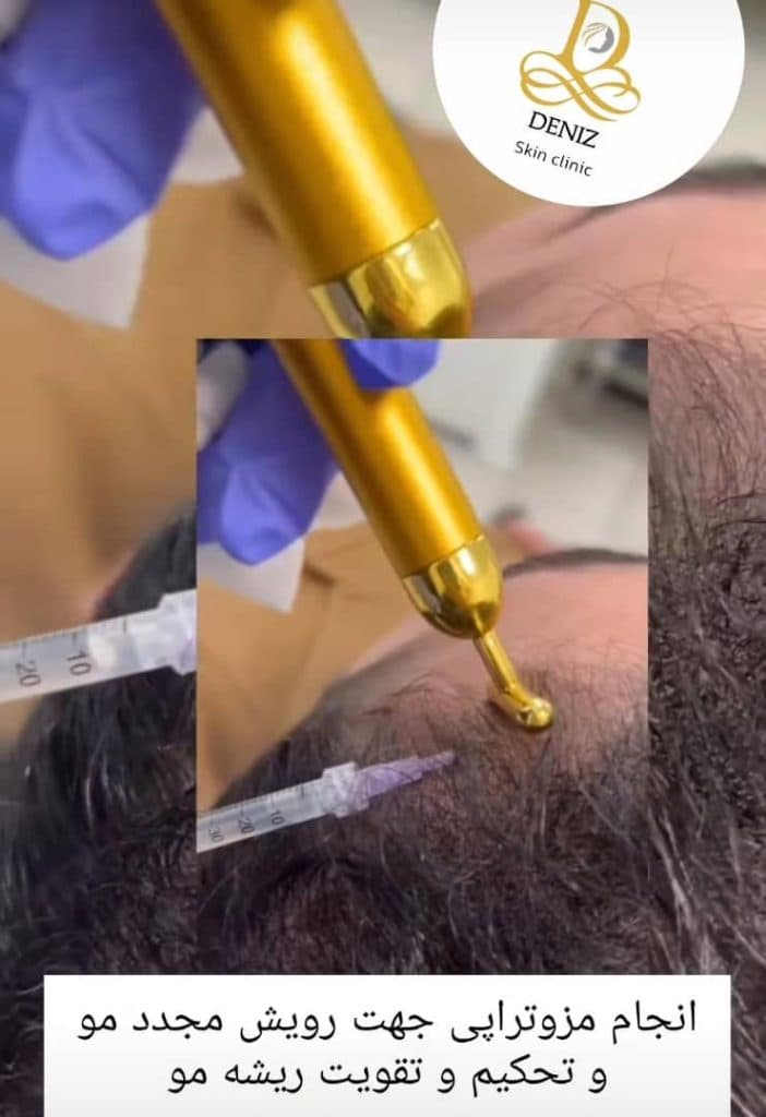 کلینیک زیبایی دنیز در پاستور جدید تبریز