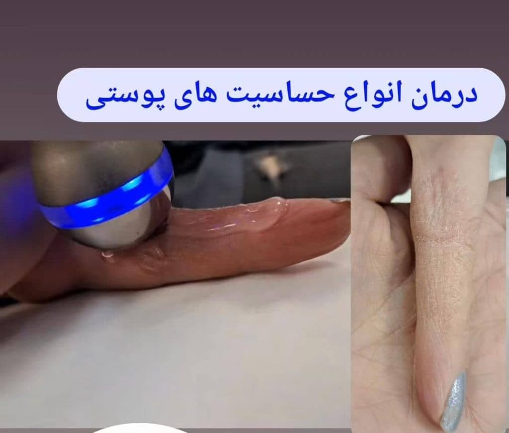 کلینیک زیبایی دنیز در پاستور جدید تبریز