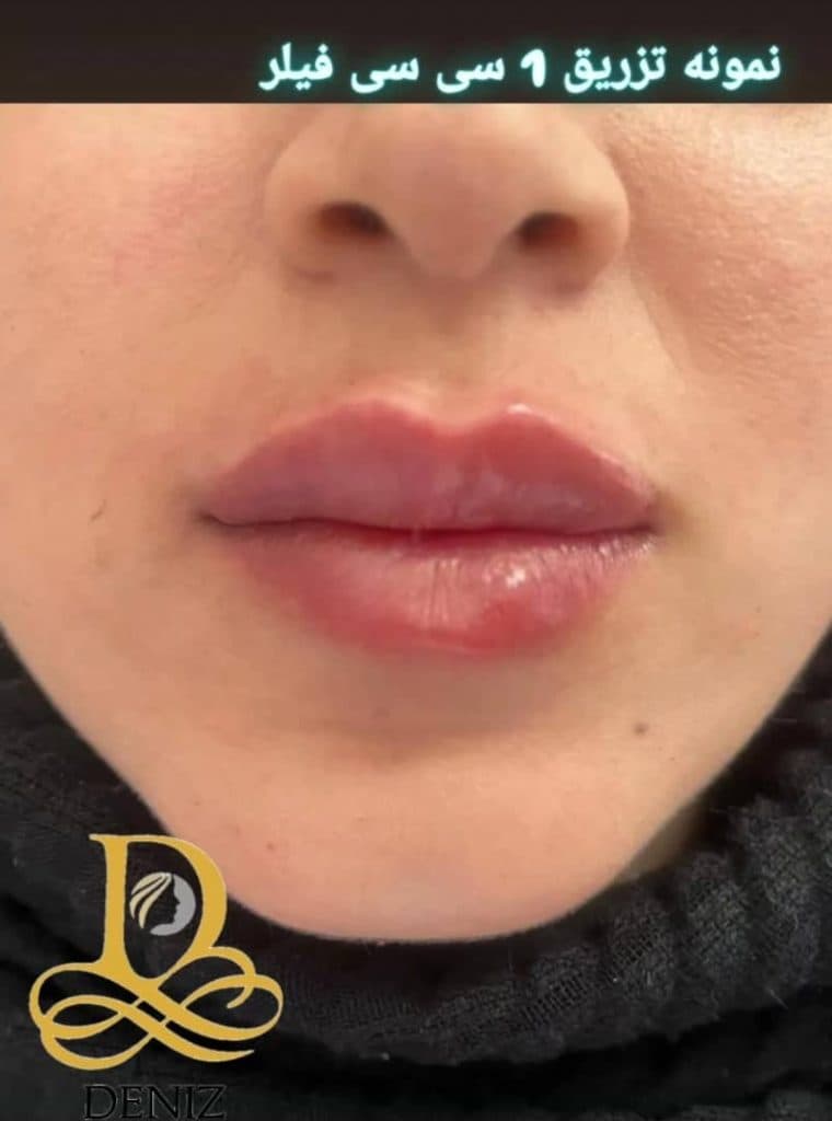 کلینیک زیبایی دنیز در پاستور جدید تبریز