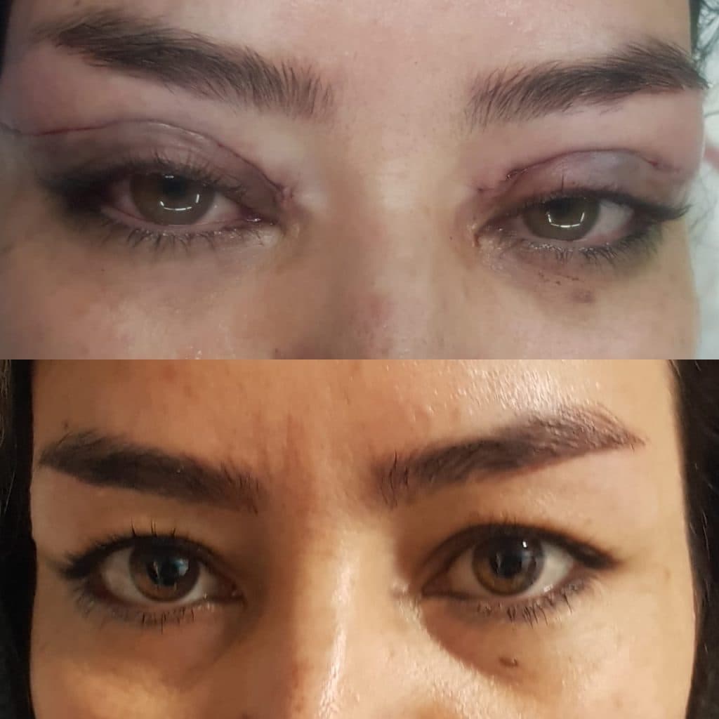 مرکز تخصصی بلفاروپلاستی دکتر نریمان مهرنیا تهرانپارس تهران