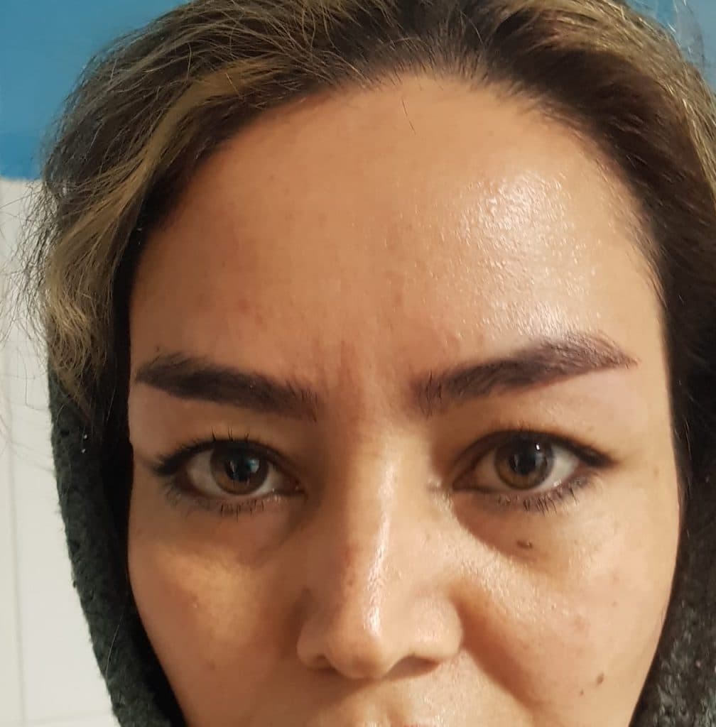 مرکز تخصصی بلفاروپلاستی دکتر نریمان مهرنیا تهرانپارس تهران