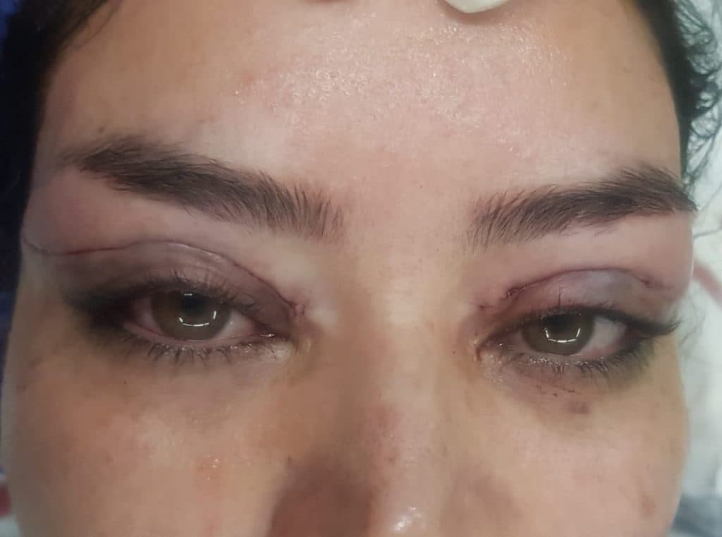 مرکز تخصصی بلفاروپلاستی دکتر نریمان مهرنیا تهرانپارس تهران