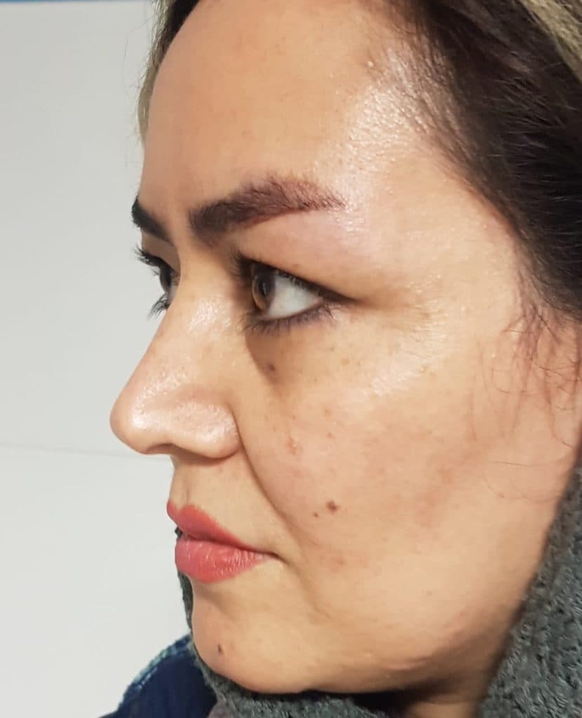 مرکز تخصصی بلفاروپلاستی دکتر نریمان مهرنیا تهرانپارس تهران