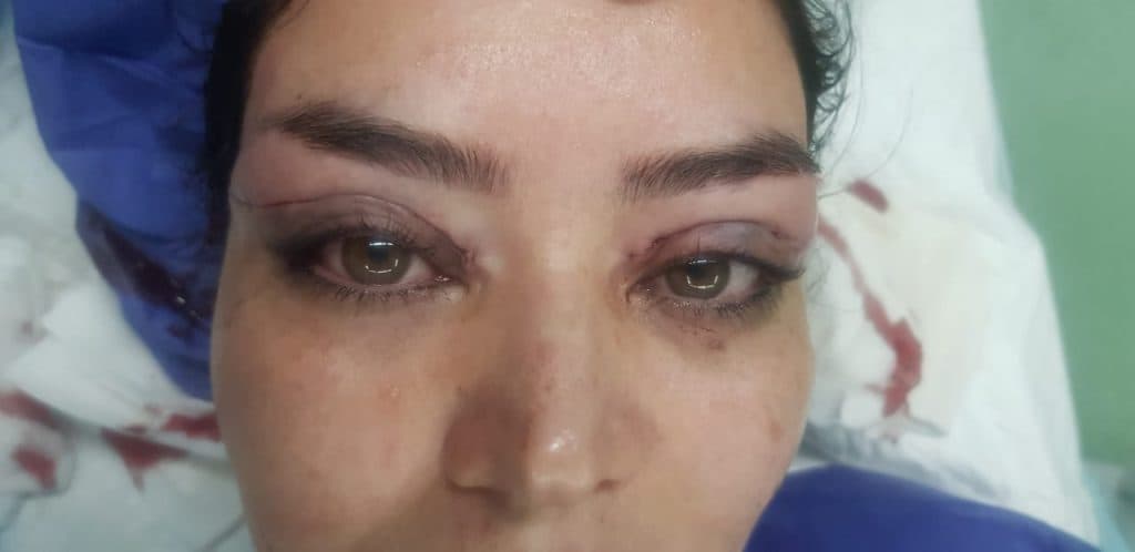 مرکز تخصصی بلفاروپلاستی دکتر نریمان مهرنیا تهرانپارس تهران