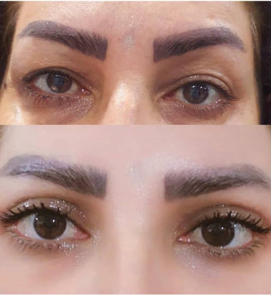 مرکز تخصصی بلفاروپلاستی دکتر نریمان مهرنیا تهرانپارس تهران