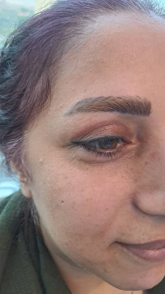 مرکز تخصصی بلفاروپلاستی دکتر نریمان مهرنیا تهرانپارس تهران