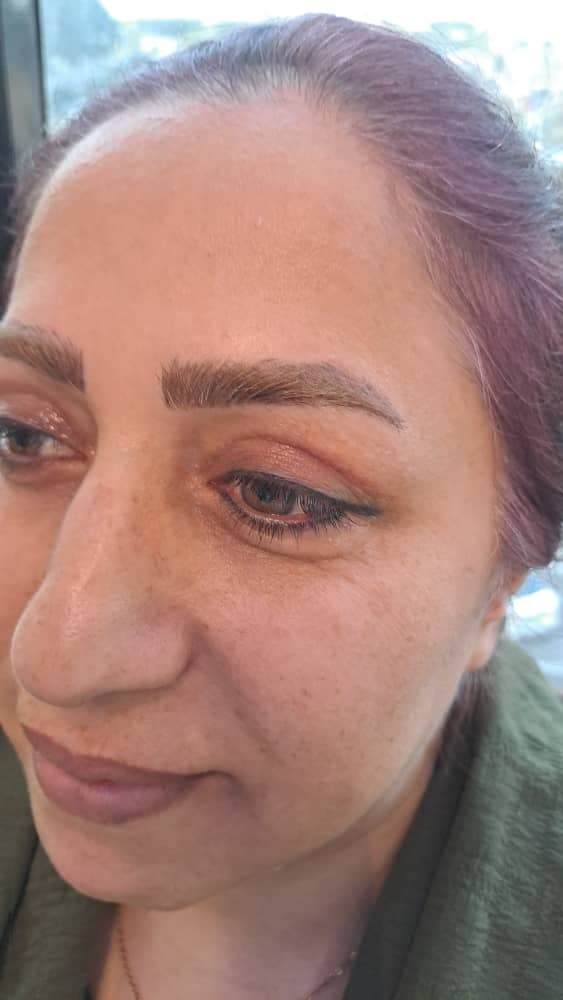 مرکز تخصصی بلفاروپلاستی دکتر نریمان مهرنیا تهرانپارس تهران