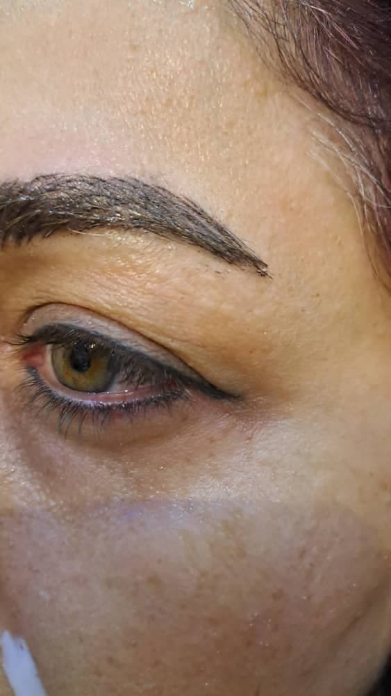 مرکز تخصصی بلفاروپلاستی دکتر نریمان مهرنیا تهرانپارس تهران