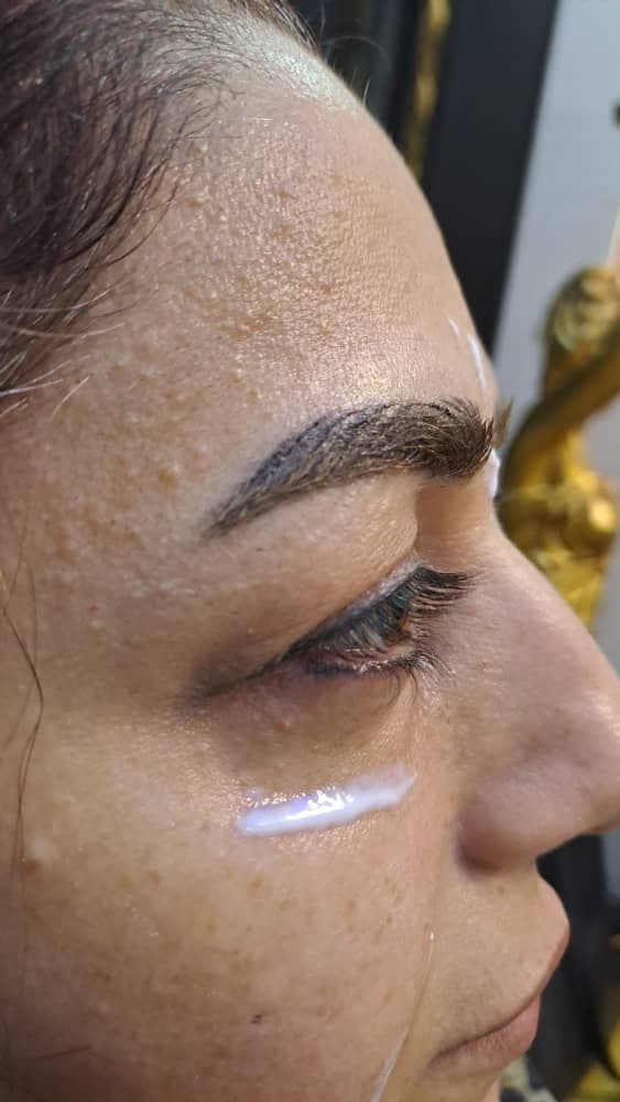 مرکز تخصصی بلفاروپلاستی دکتر نریمان مهرنیا تهرانپارس تهران