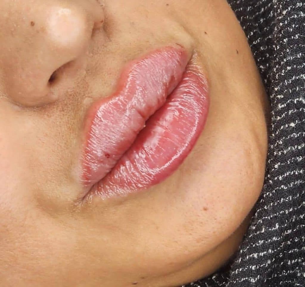 مرکز تخصصی تزریق ژل لب دکتر پوریا پورسهرابی کرمان