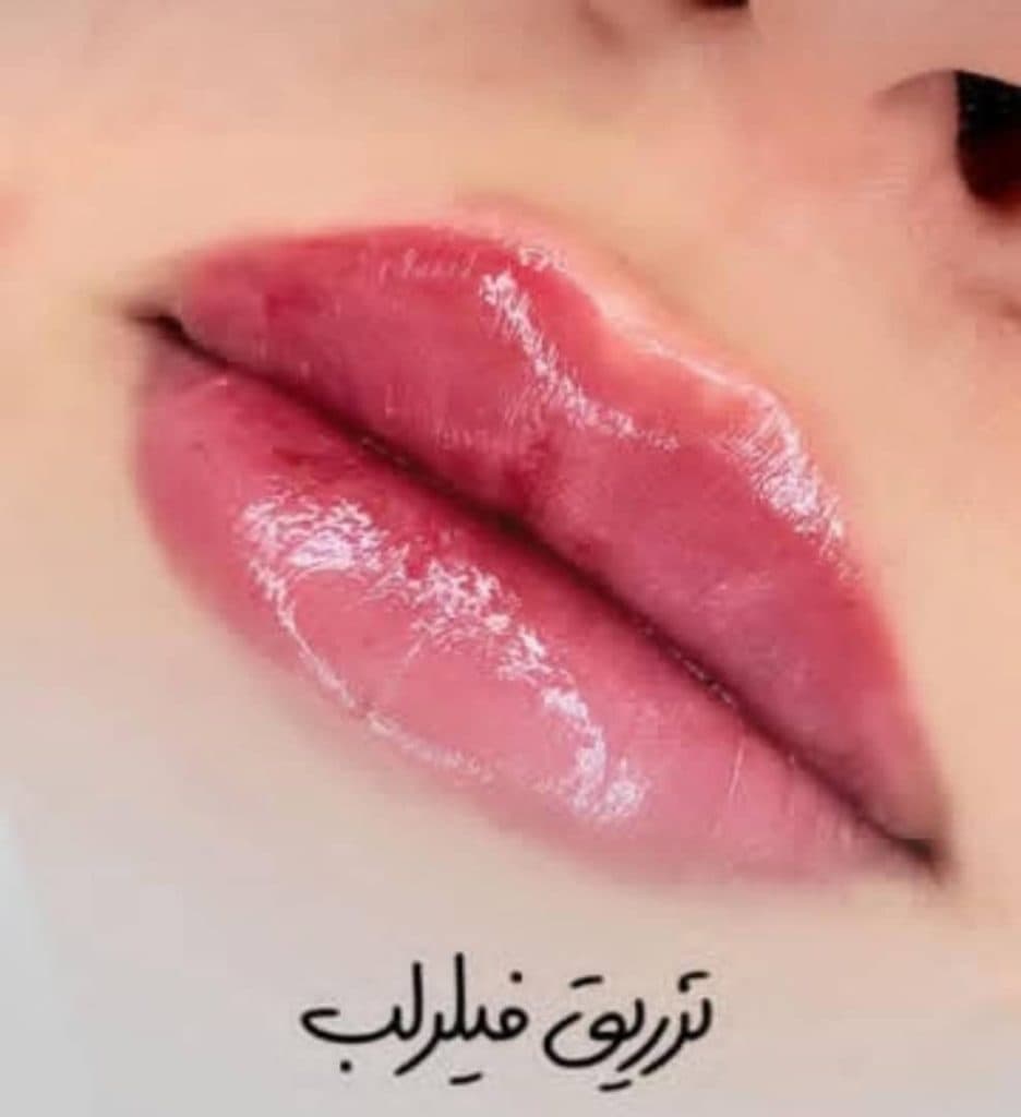 مرکز تخصصی تزریق ژل لب دکتر پوریا پورسهرابی کرمان