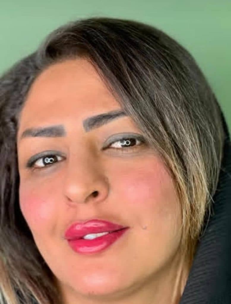 مرکز تخصصی تزریق ژل لب دکتر پوریا پورسهرابی کرمان