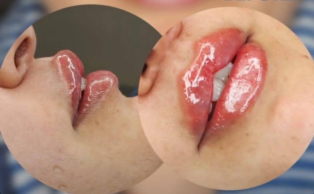 مرکز تخصصی تزریق ژل لب دکتر پوریا پورسهرابی کرمان