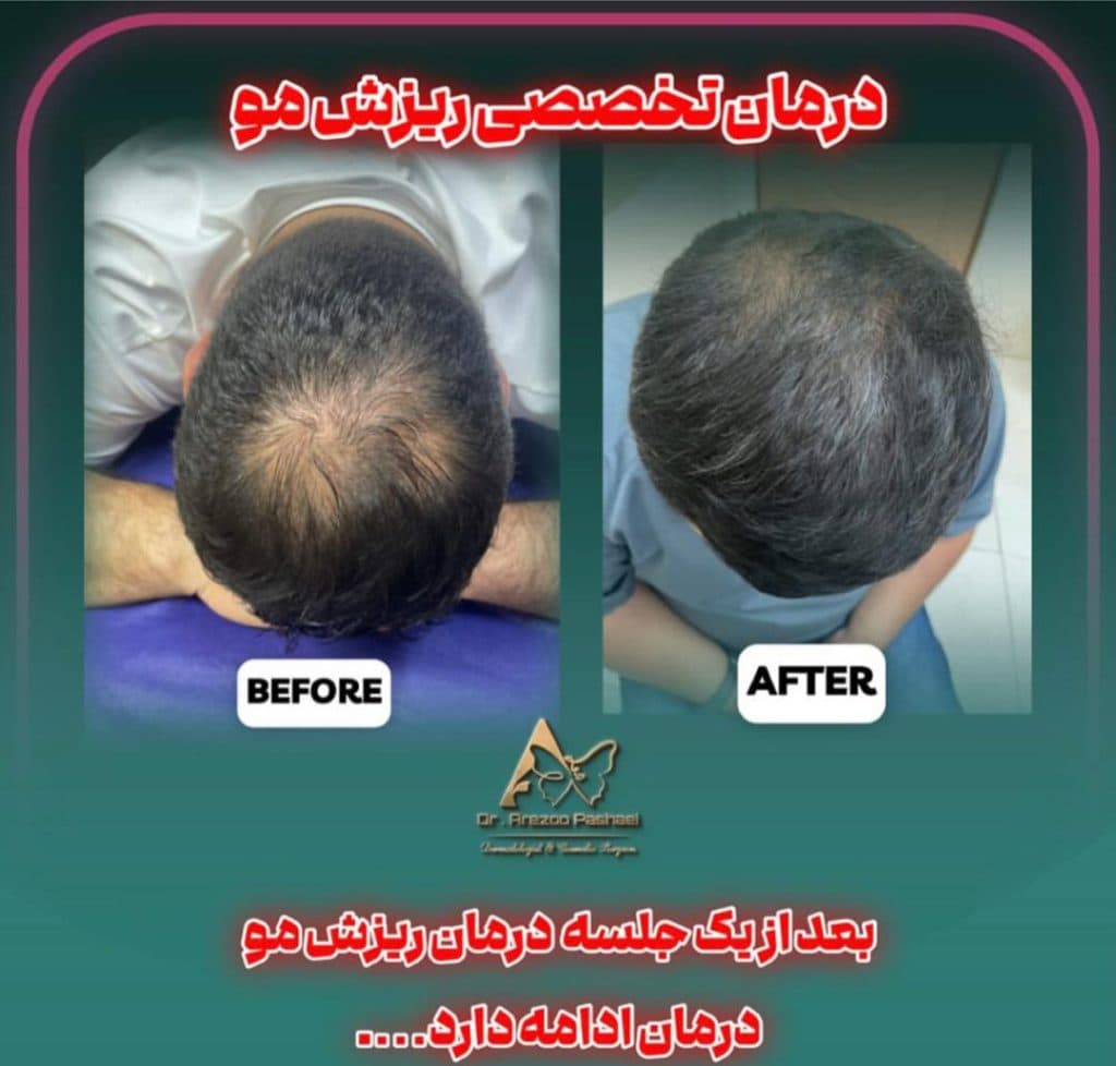 مطب زیبایی پوست و مو دکتر آرزو پاشایی متخصص و جراح در تنکابن