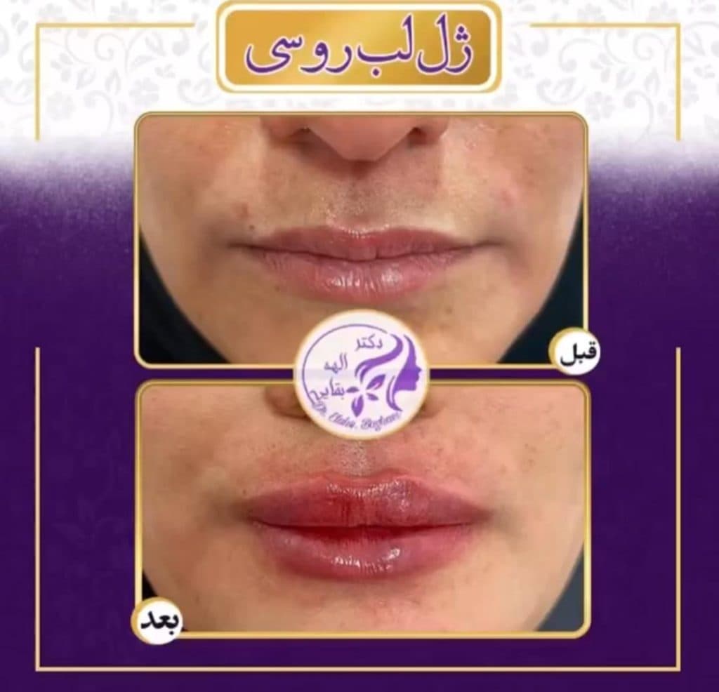 مطب زیبایی پوست و مو دکتر الهه بقایی در کرمان