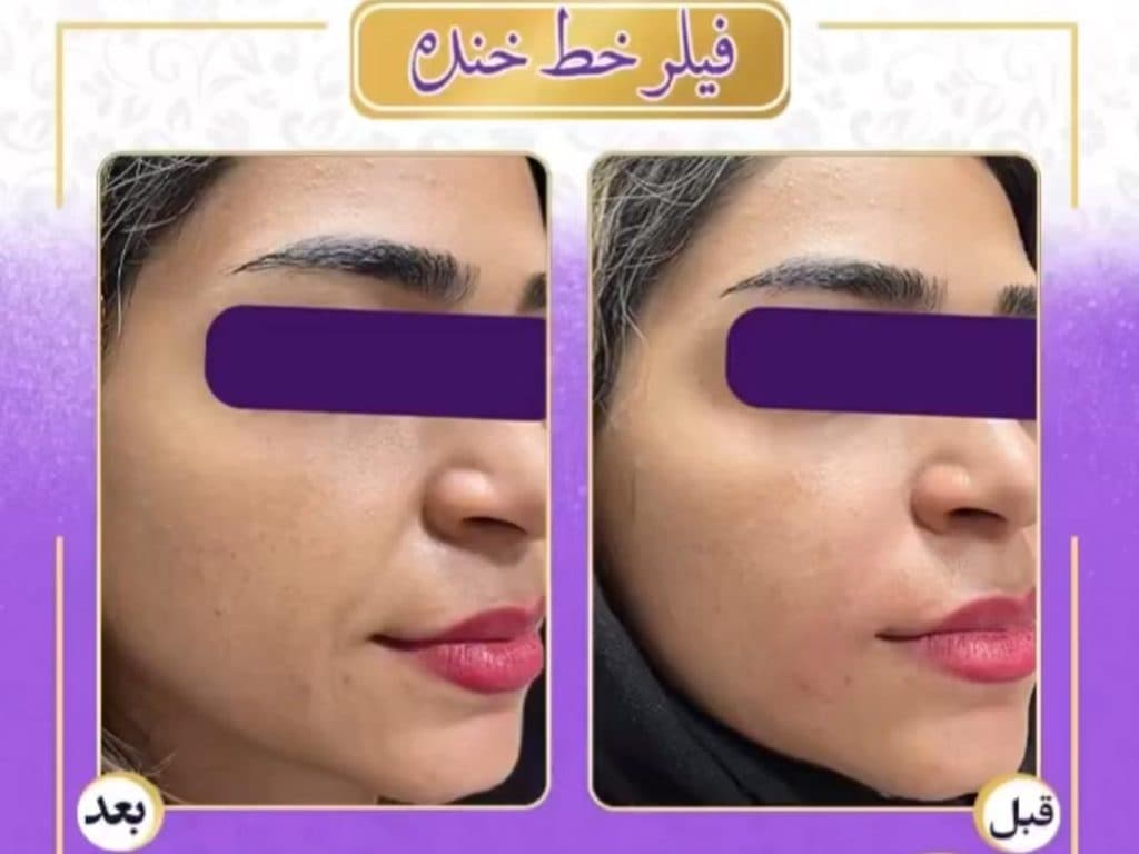 مطب زیبایی پوست و مو دکتر الهه بقایی در کرمان