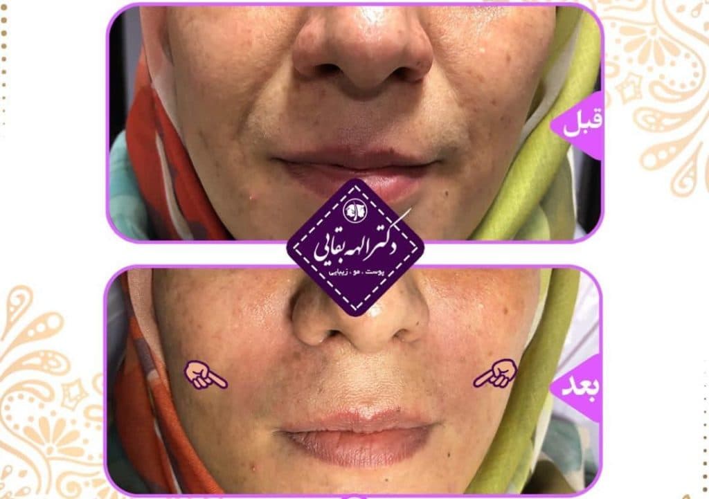 مطب زیبایی پوست و مو دکتر الهه بقایی در کرمان