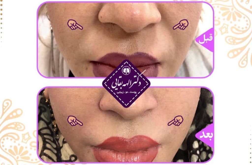 مطب زیبایی پوست و مو دکتر الهه بقایی در کرمان