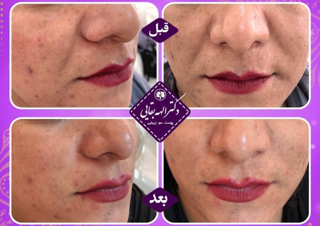 مطب زیبایی پوست و مو دکتر الهه بقایی در کرمان