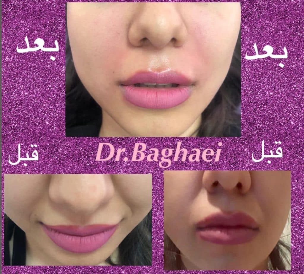 مطب زیبایی پوست و مو دکتر الهه بقایی در کرمان